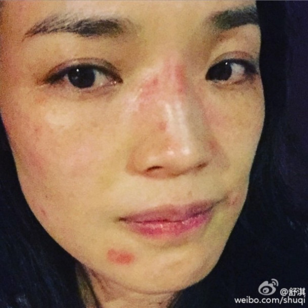 第2张图片