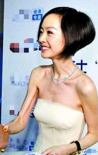 第4张图片
