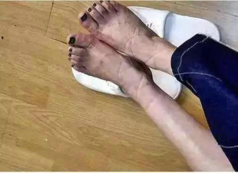 第2张图片