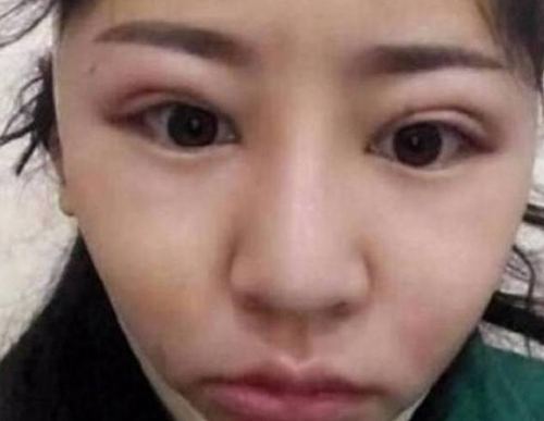 第3张图片